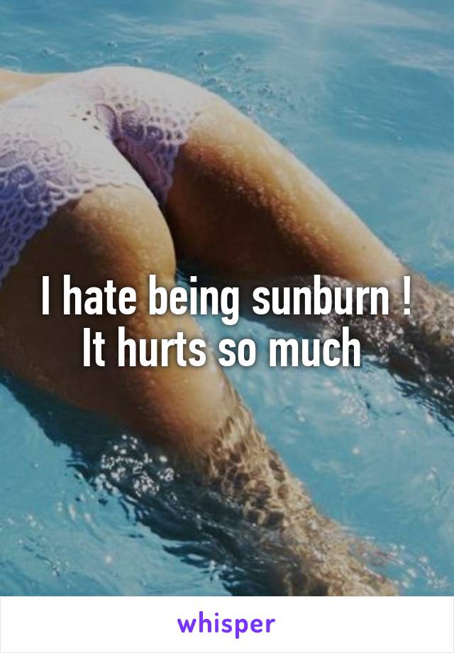 I hate being sunburn ! It hurts so much 