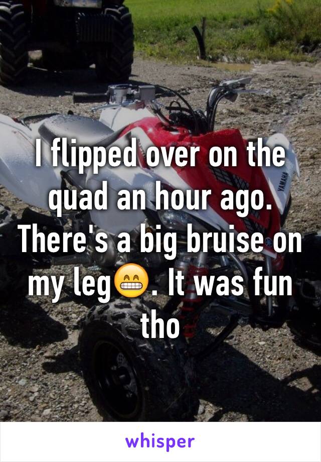 I flipped over on the quad an hour ago. There's a big bruise on my leg😁. It was fun tho 