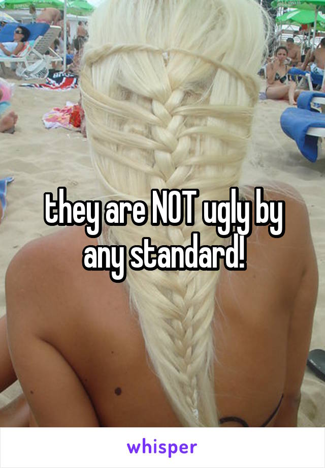 they are NOT ugly by any standard!