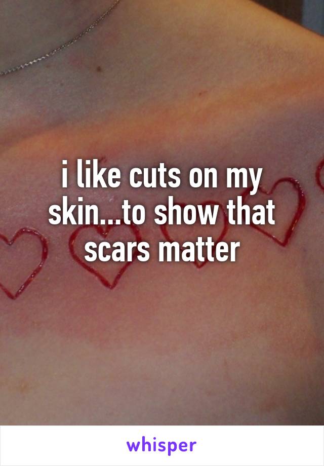 i like cuts on my skin...to show that scars matter
