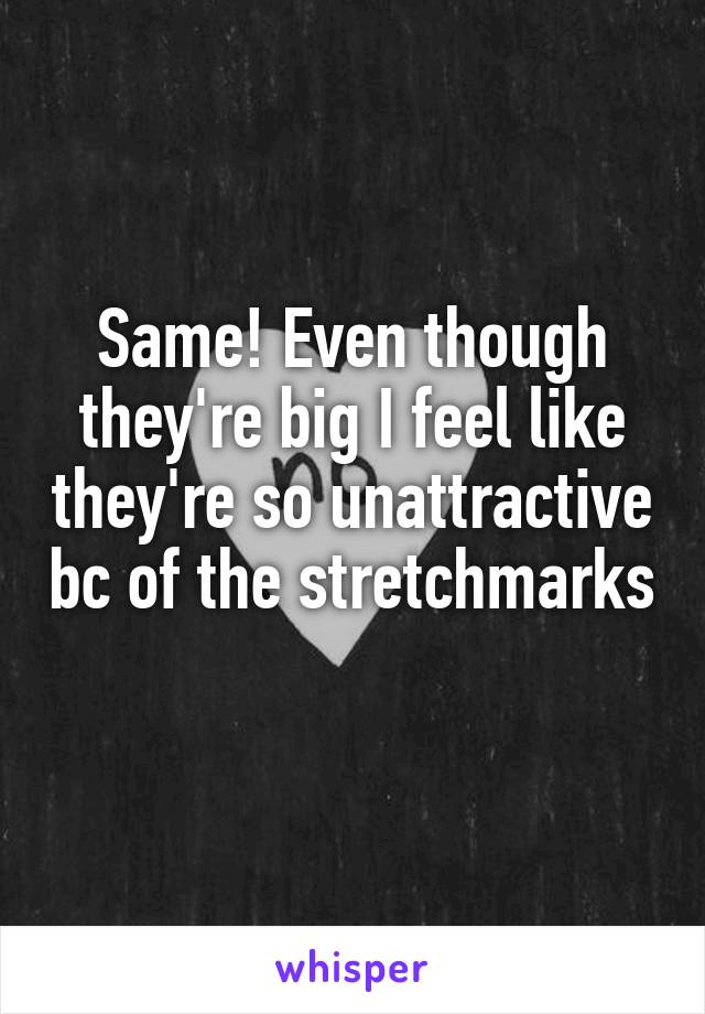 Same! Even though they're big I feel like they're so unattractive bc of the stretchmarks 