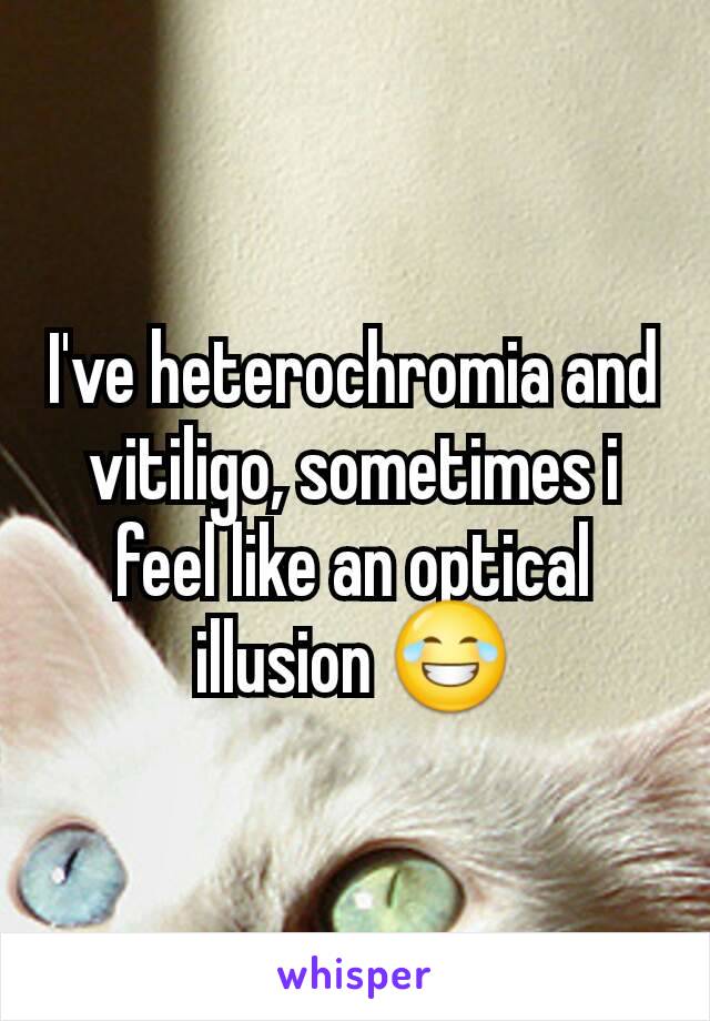 I've heterochromia and vitiligo, sometimes i feel like an optical illusion 😂