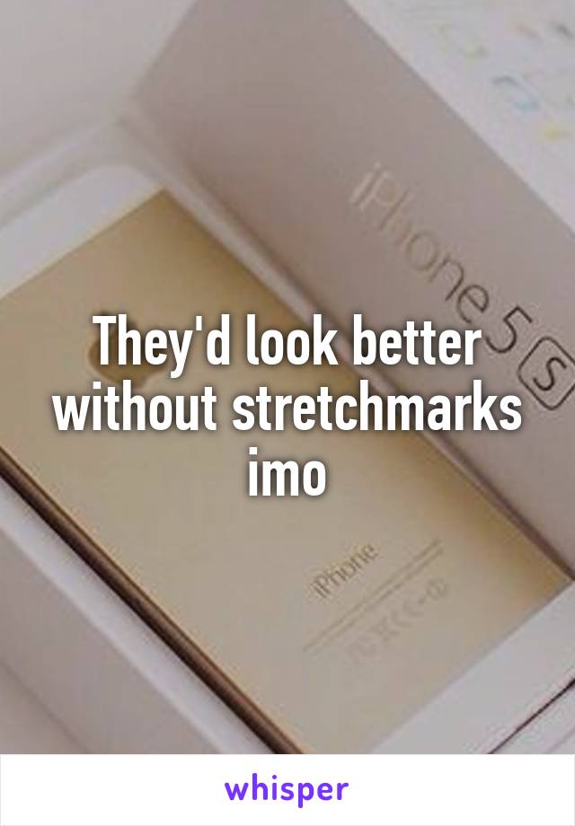 They'd look better without stretchmarks imo