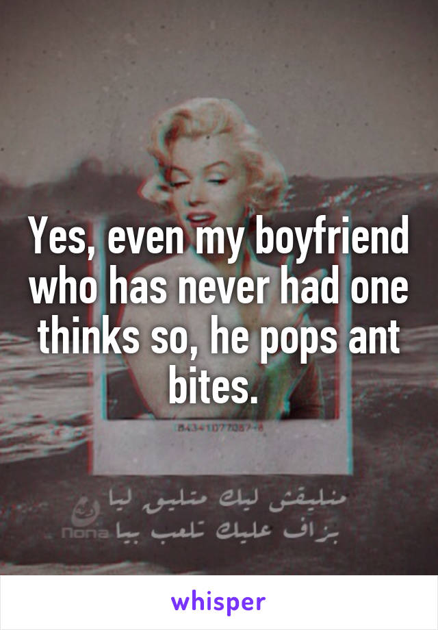 Yes, even my boyfriend who has never had one thinks so, he pops ant bites. 