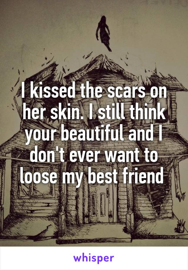 I kissed the scars on her skin. I still think your beautiful and I don't ever want to loose my best friend 