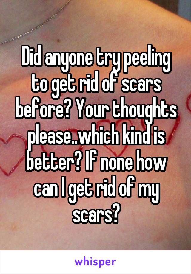 Did anyone try peeling to get rid of scars before? Your thoughts please..which kind is better? If none how can I get rid of my scars?