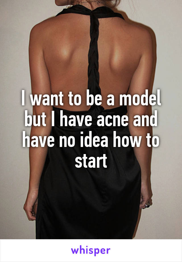 I want to be a model but I have acne and have no idea how to start