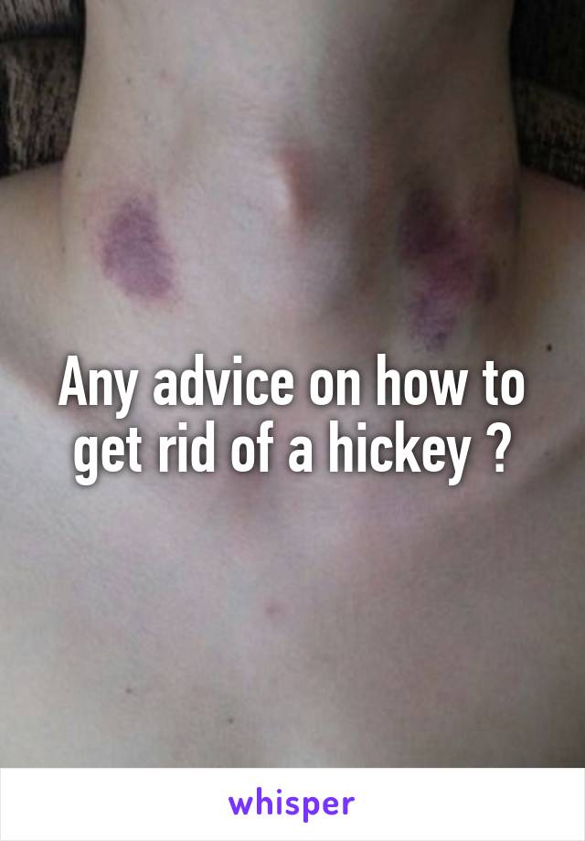 Any advice on how to get rid of a hickey ?