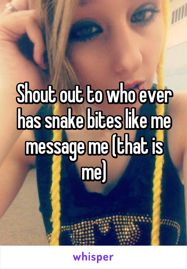 Shout out to who ever has snake bites like me message me (that is me)