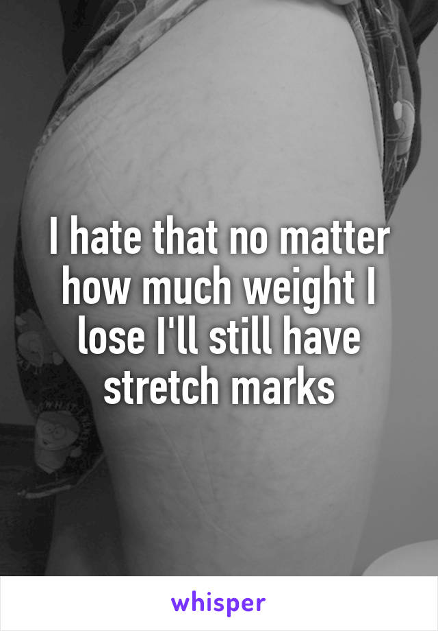 I hate that no matter how much weight I lose I'll still have stretch marks