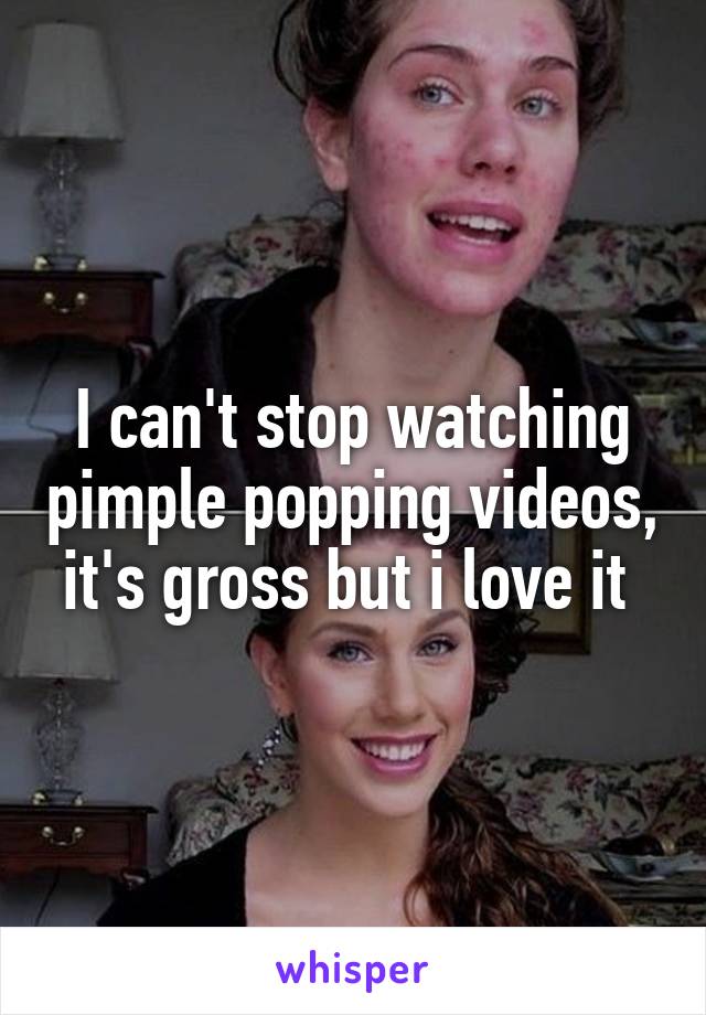 I can't stop watching pimple popping videos, it's gross but i love it 