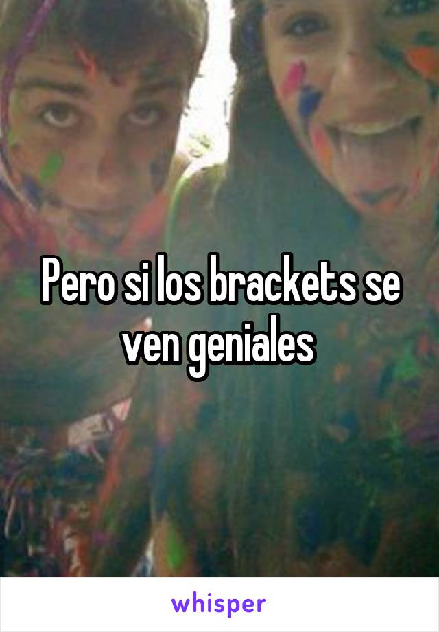 Pero si los brackets se ven geniales 