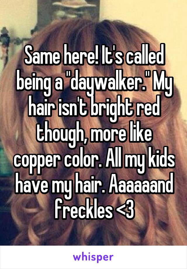 Same here! It's called being a "daywalker." My hair isn't bright red though, more like copper color. All my kids have my hair. Aaaaaand freckles <3