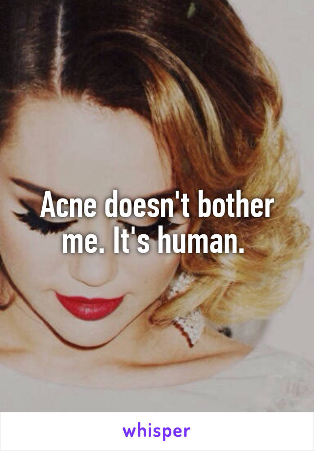 Acne doesn't bother me. It's human. 