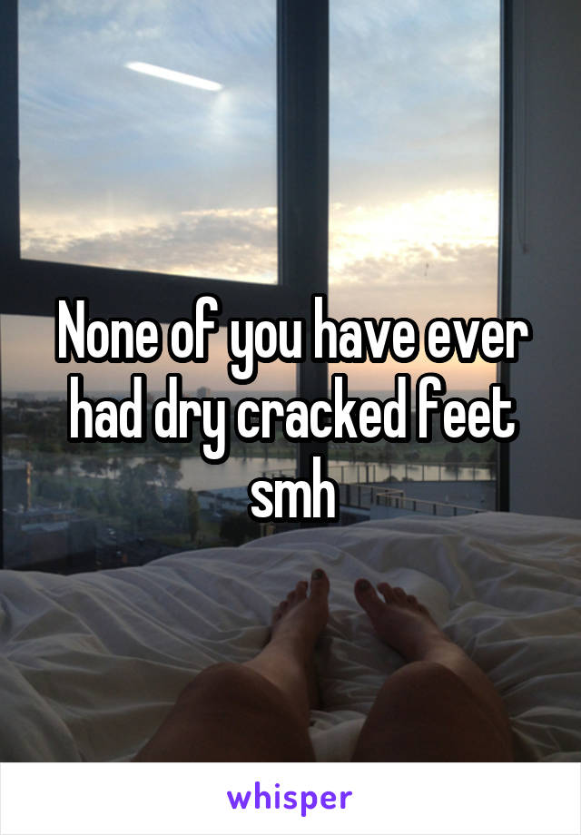 None of you have ever had dry cracked feet smh