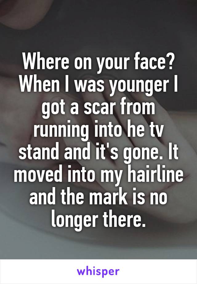 Where on your face? When I was younger I got a scar from running into he tv stand and it's gone. It moved into my hairline and the mark is no longer there.