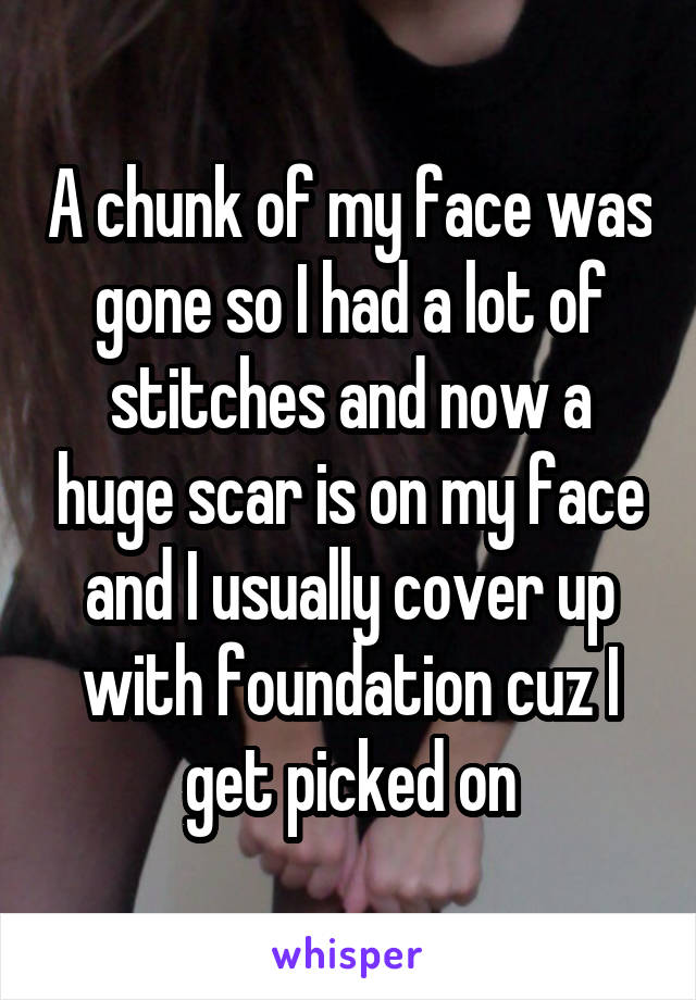 A chunk of my face was gone so I had a lot of stitches and now a huge scar is on my face and I usually cover up with foundation cuz I get picked on