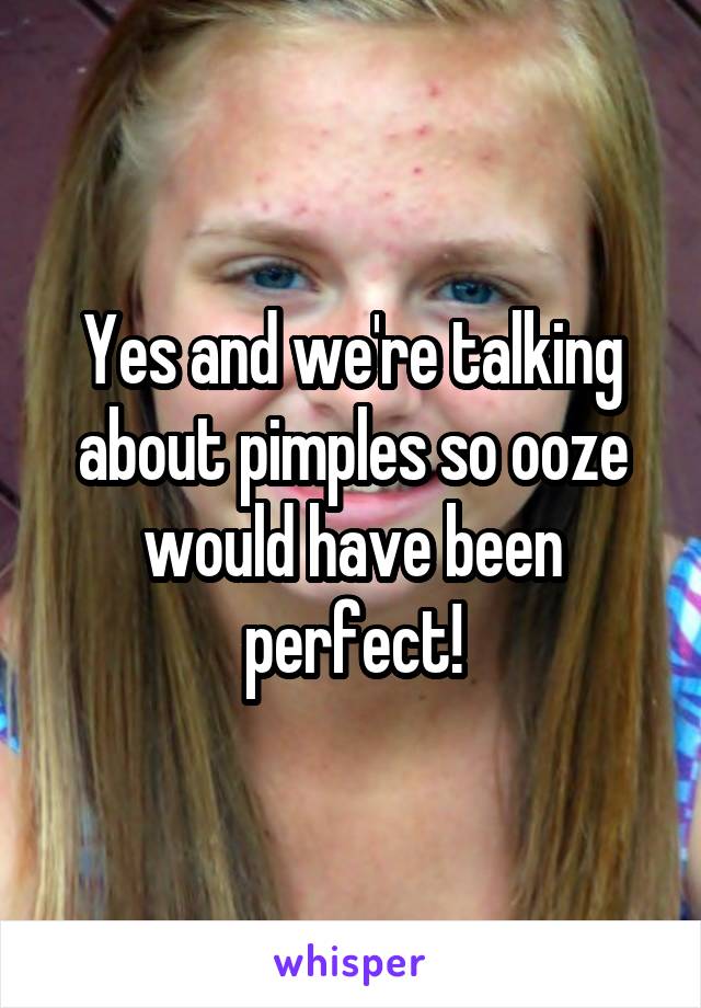 Yes and we're talking about pimples so ooze would have been perfect!