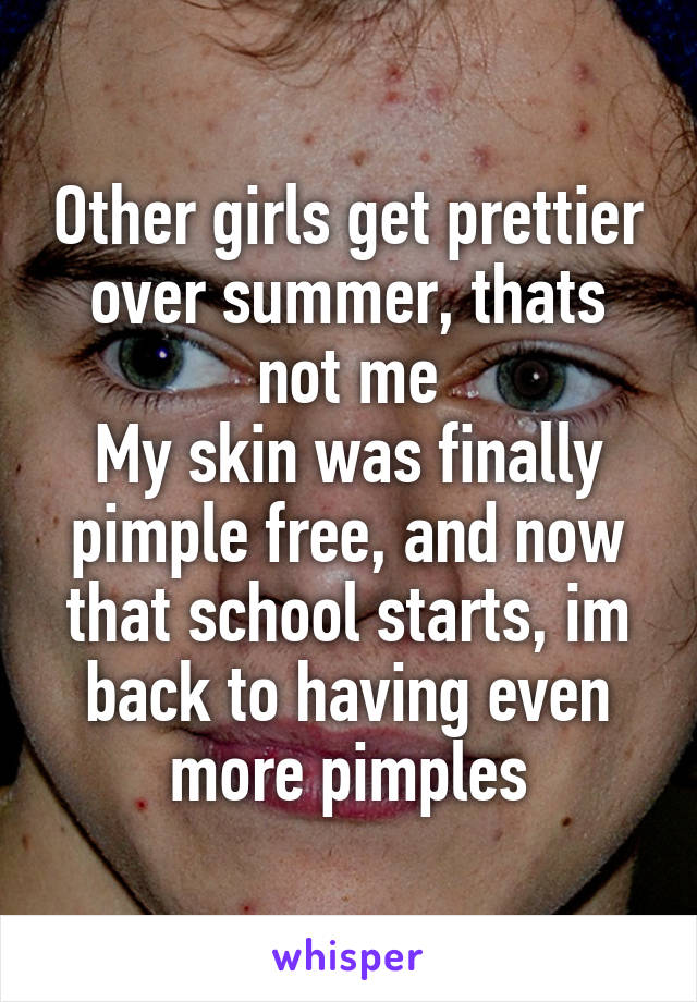 Other girls get prettier over summer, thats not me
My skin was finally pimple free, and now that school starts, im back to having even more pimples