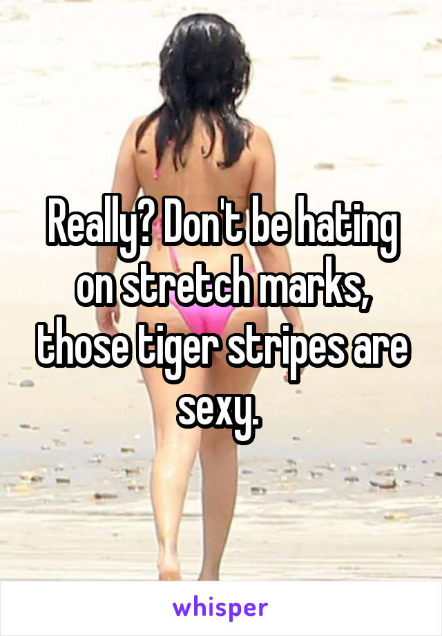 Really? Don't be hating on stretch marks, those tiger stripes are sexy. 