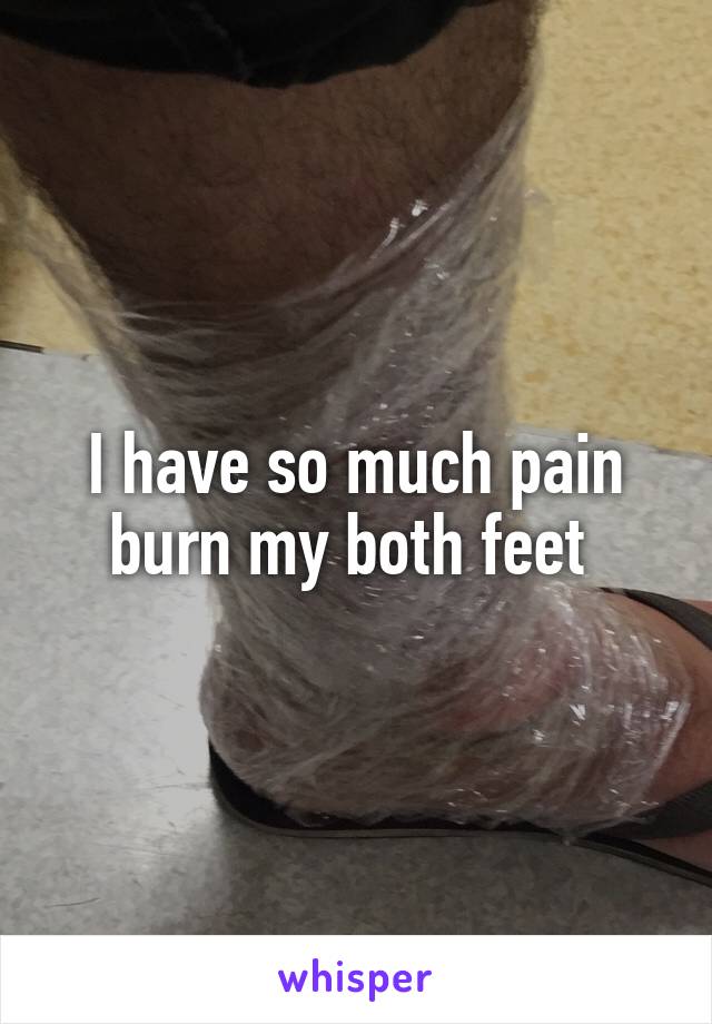 I have so much pain burn my both feet 