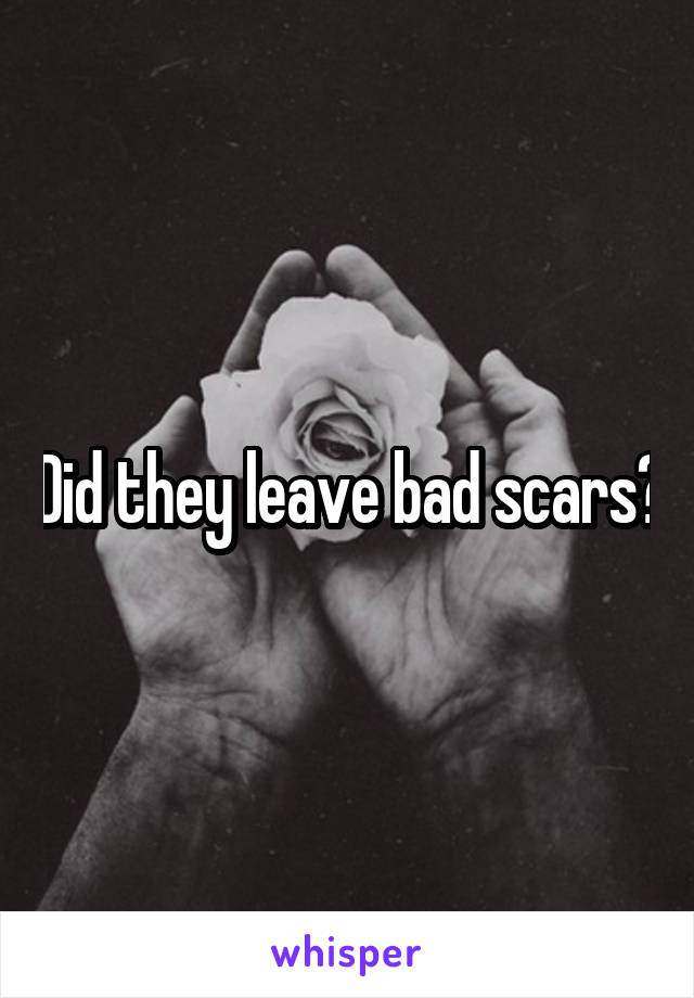 Did they leave bad scars?