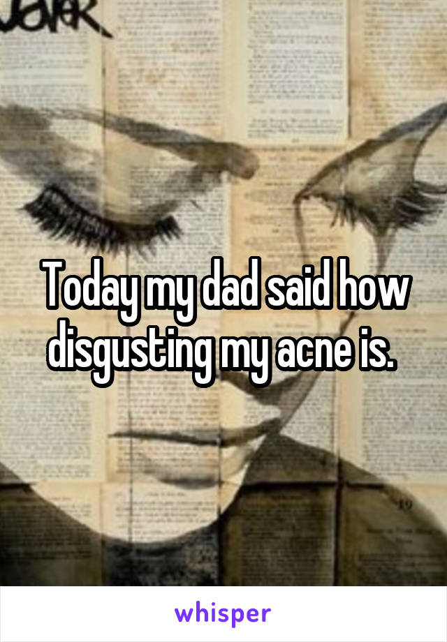 Today my dad said how disgusting my acne is. 