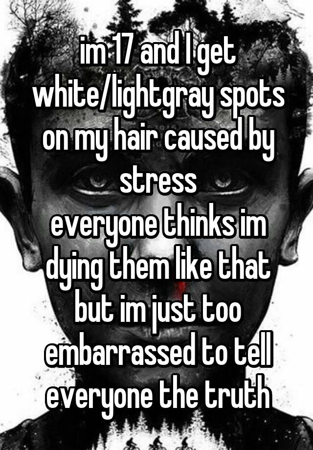 im-17-and-i-get-white-lightgray-spots-on-my-hair-caused-by-stress