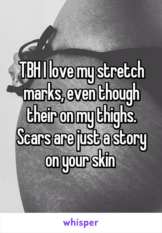 TBH I love my stretch marks, even though their on my thighs. Scars are just a story on your skin 