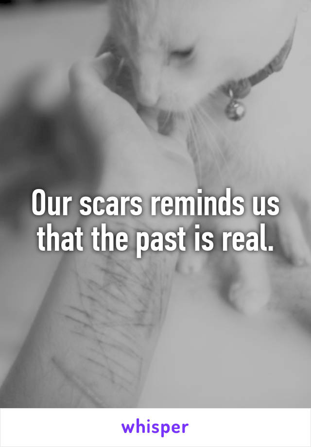 Our scars reminds us that the past is real.