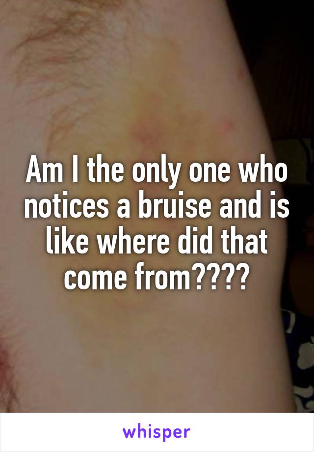 Am I the only one who notices a bruise and is like where did that come from????