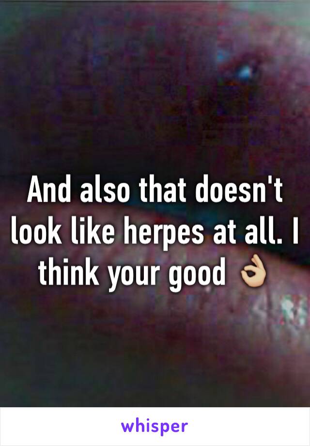 And also that doesn't look like herpes at all. I think your good 👌🏼