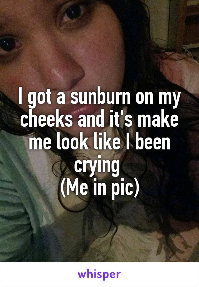 I got a sunburn on my cheeks and it's make me look like I been crying 
(Me in pic)