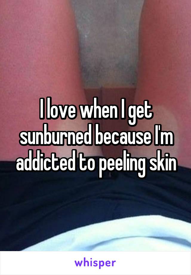 I love when I get sunburned because I'm addicted to peeling skin