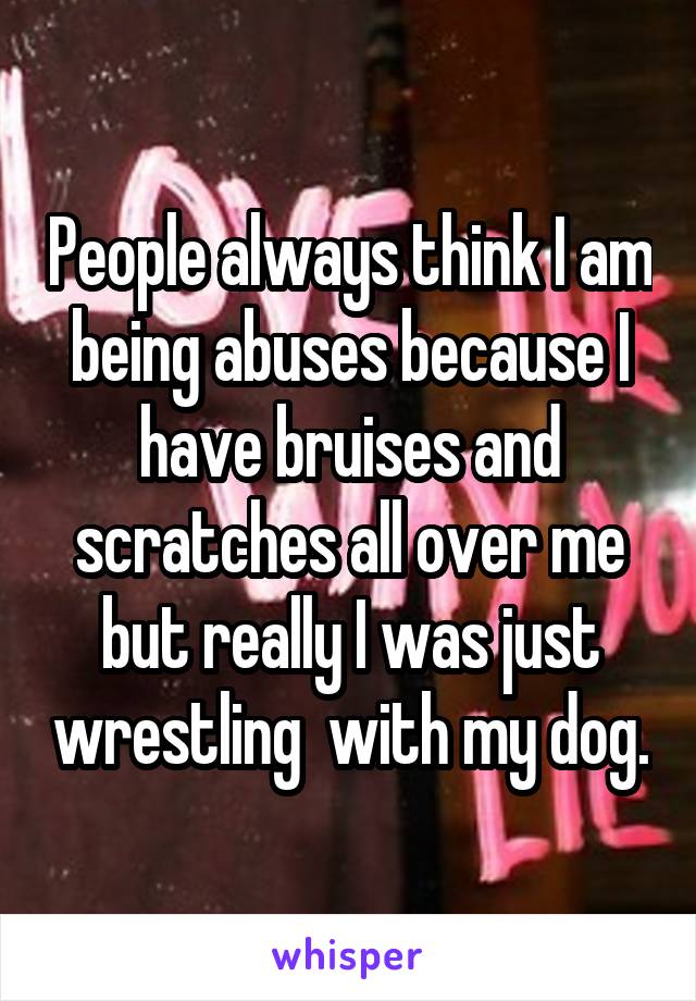 People always think I am being abuses because I have bruises and scratches all over me but really I was just wrestling  with my dog.