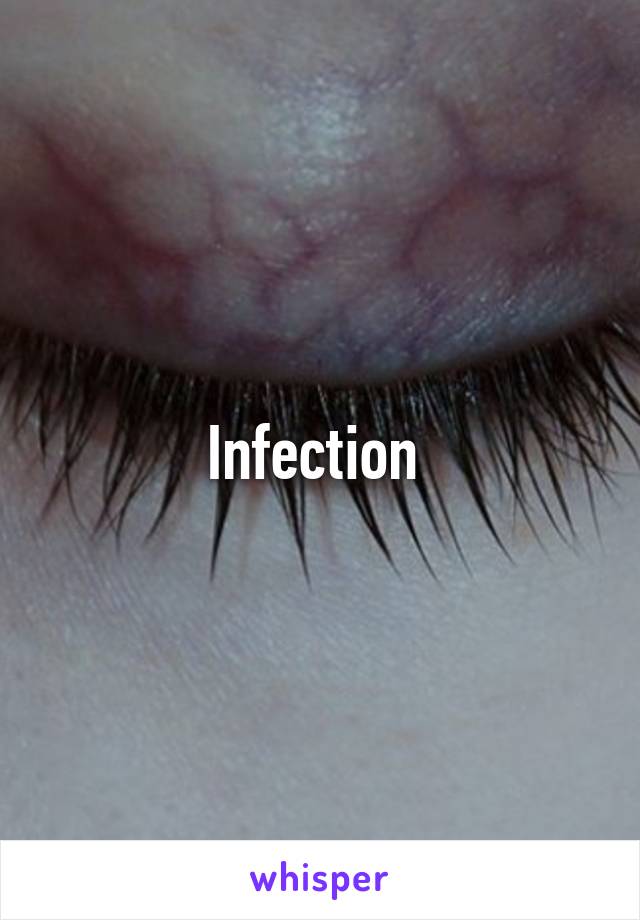 Infection 
