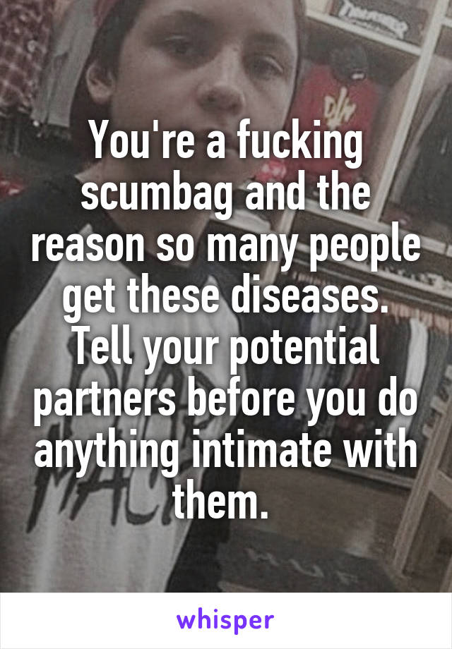 You're a fucking scumbag and the reason so many people get these diseases. Tell your potential partners before you do anything intimate with them. 