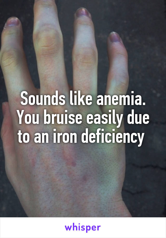 Sounds like anemia. You bruise easily due to an iron deficiency 