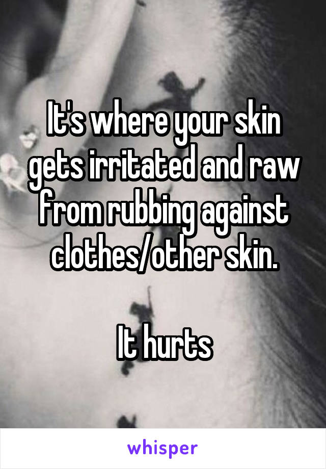 It's where your skin gets irritated and raw from rubbing against clothes/other skin.

It hurts