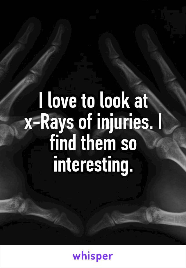 I love to look at x-Rays of injuries. I find them so interesting.