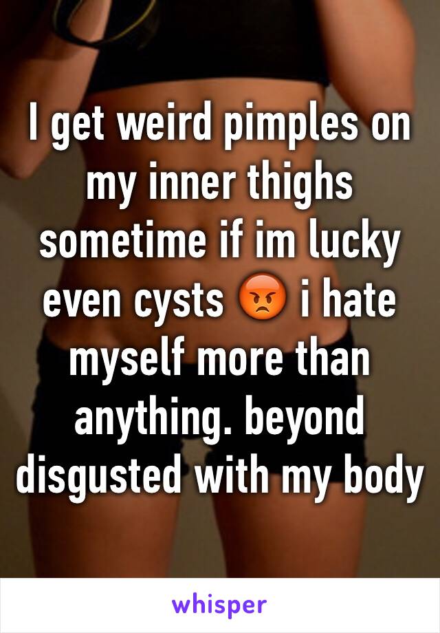 I get weird pimples on my inner thighs sometime if im lucky even cysts 😡 i hate myself more than anything. beyond disgusted with my body