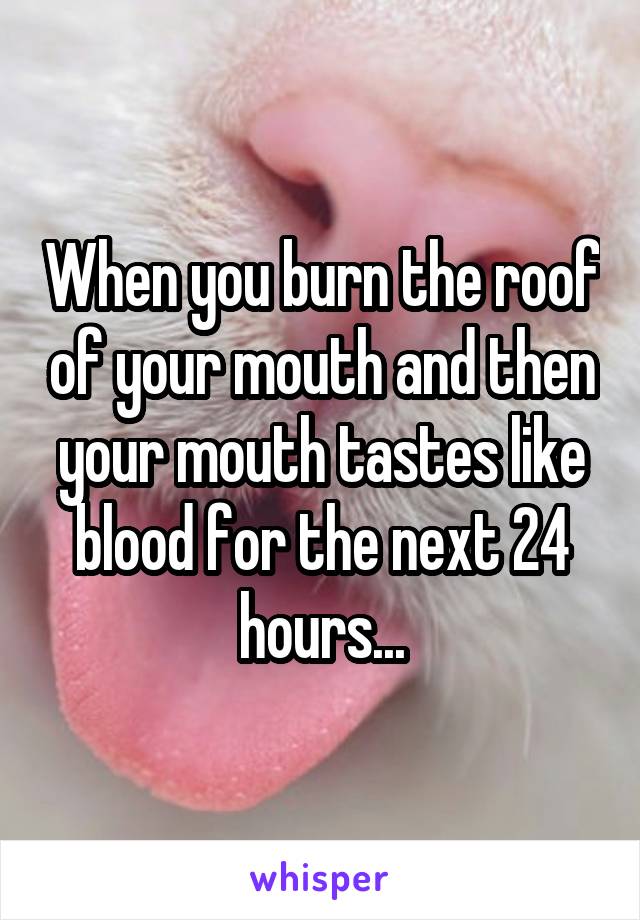 When you burn the roof of your mouth and then your mouth tastes like blood for the next 24 hours...