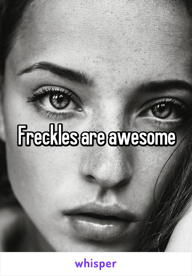 Freckles are awesome