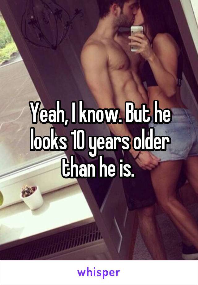 Yeah, I know. But he looks 10 years older than he is. 