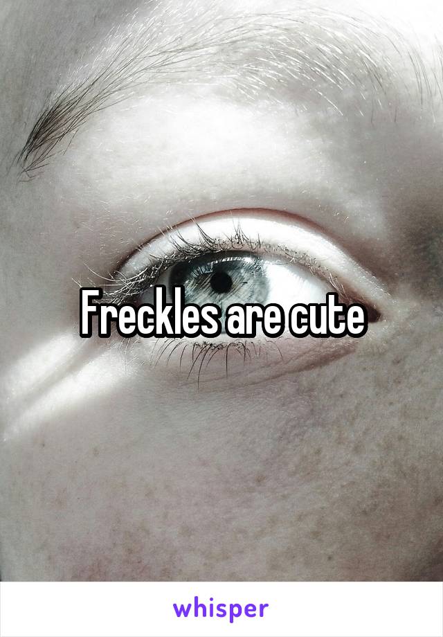 Freckles are cute