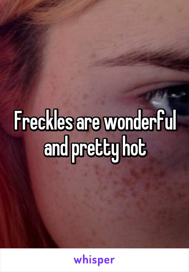 Freckles are wonderful and pretty hot