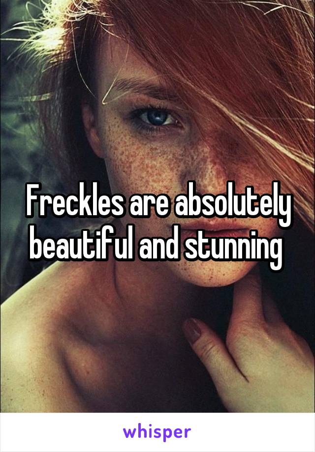 Freckles are absolutely beautiful and stunning 