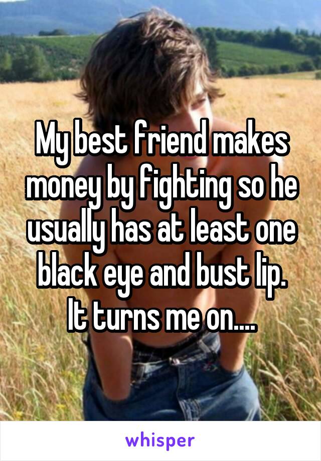 My best friend makes money by fighting so he usually has at least one black eye and bust lip.
It turns me on....