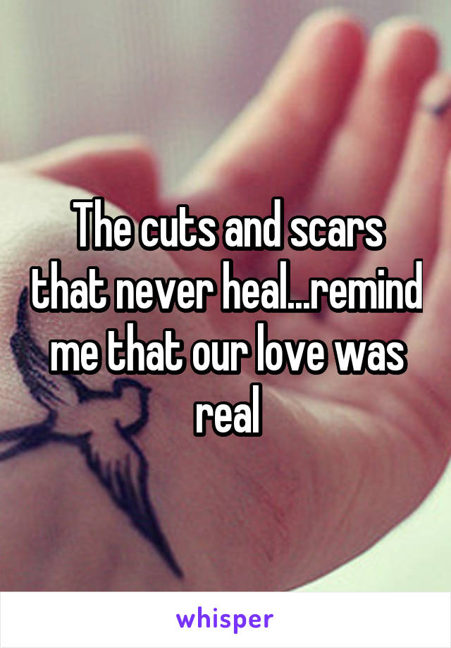 The cuts and scars that never heal...remind me that our love was real