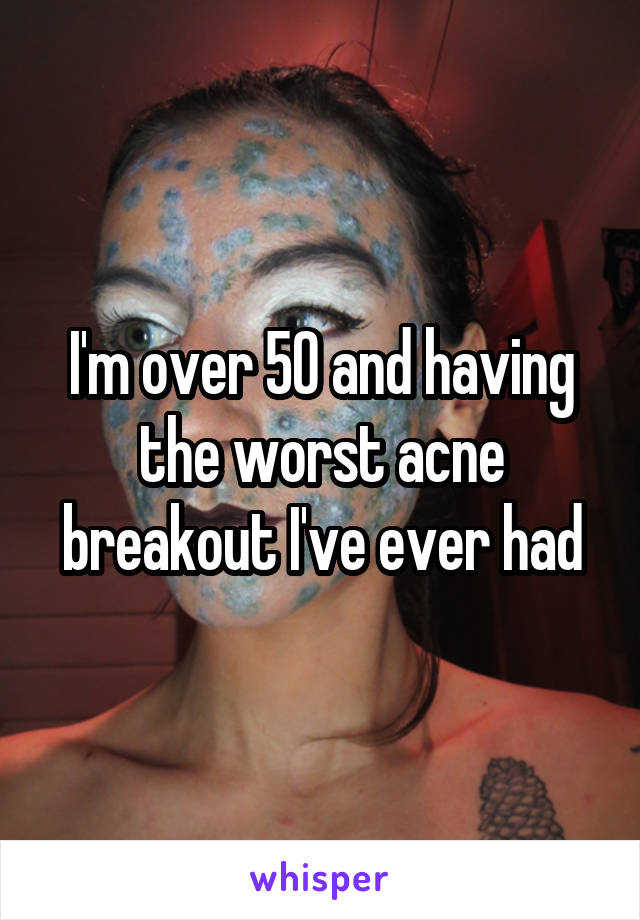I'm over 50 and having the worst acne breakout I've ever had